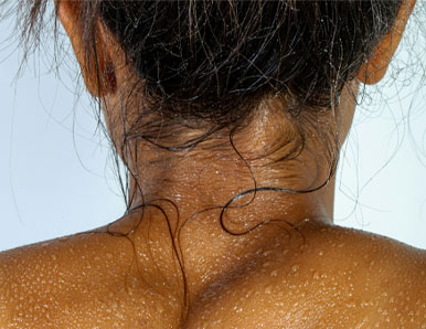 העור שבו אני חי – 3 אנקדוטות על האיבר הגדול בגוף